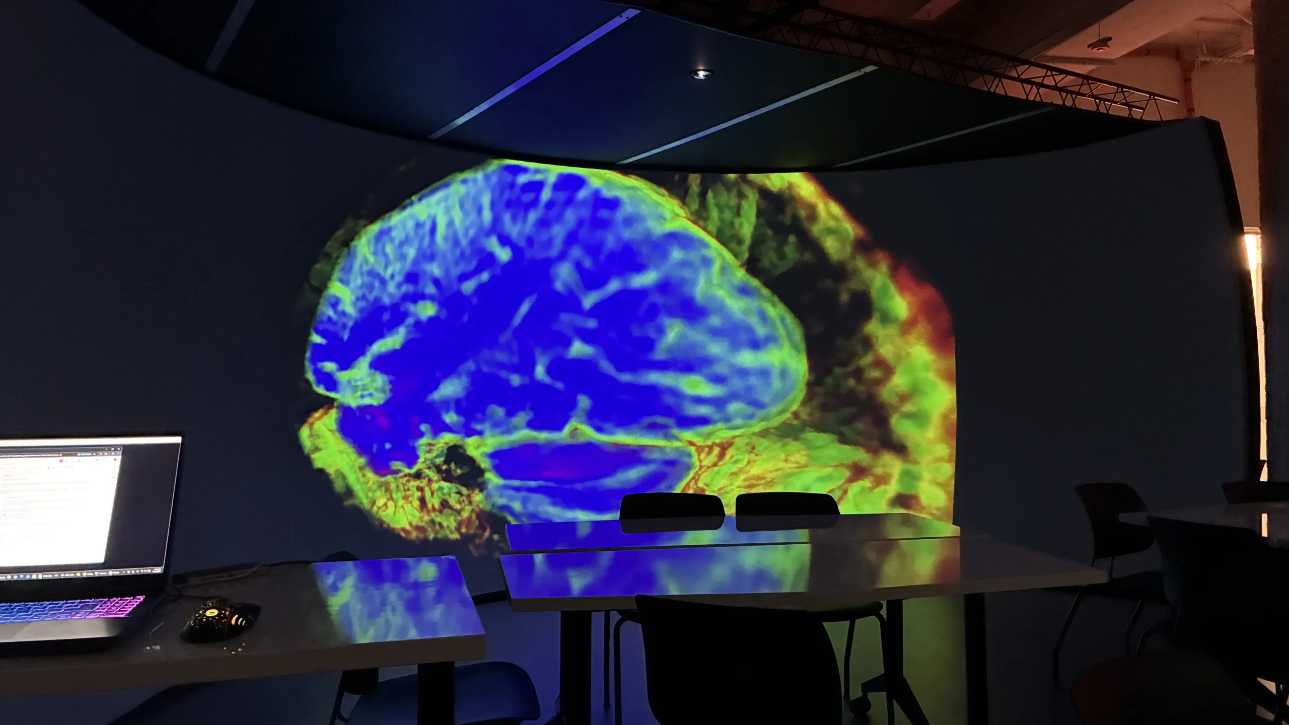 ltd_brain